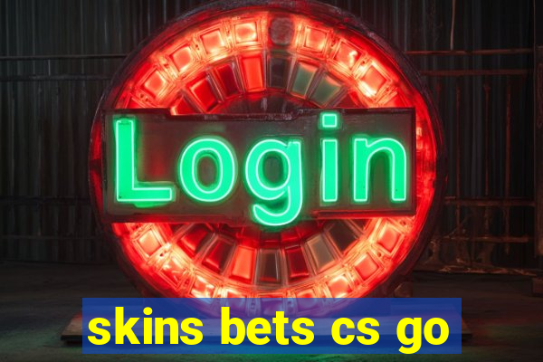 skins bets cs go