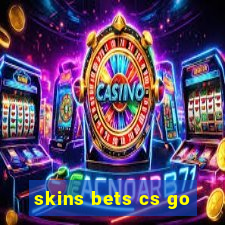 skins bets cs go