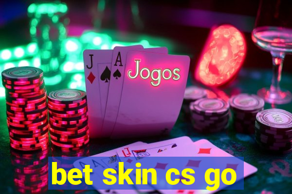 bet skin cs go