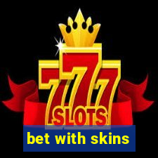 bet with skins