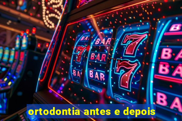 ortodontia antes e depois